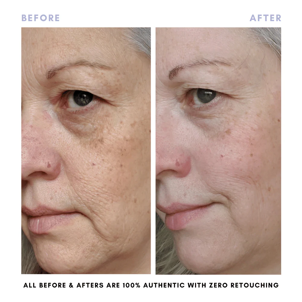 The Balanced Skin Set (Travel-Size) - Image 9