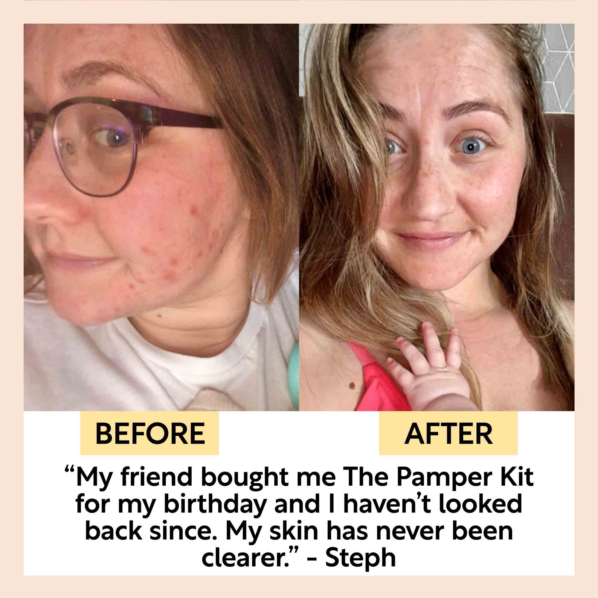 The Pamper Kit - 17 Pieces - Image 8