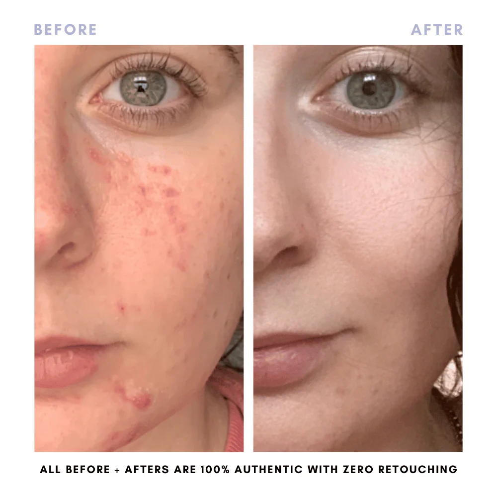 The Skin Reset Starter Kit - Image 12